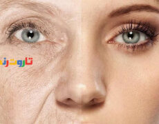 پیری زودرس: ۶ علامت پیری زودرس / جلوگیری از پیری زودرس