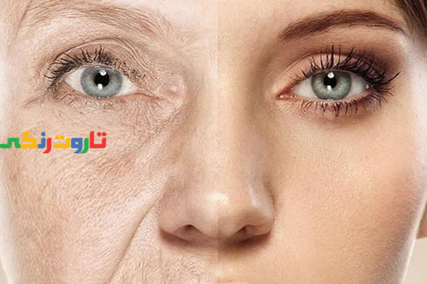 پیری زودرس, علائم پیری زودرس, نشانه های پیری زودرس, پیشگیری از پیری زودرس, جلوگیری از پیری زودرس