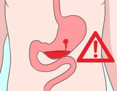 خونریزی معده و هر آنچه که باید درباره آن بدانید!