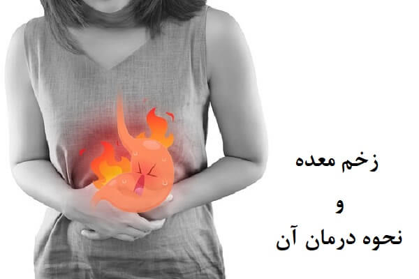 زخم معده و نحوه درمان آن
