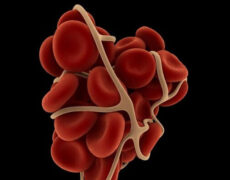 لخته شدن خون  و هر آنچه که باید درباره آن بدانید!