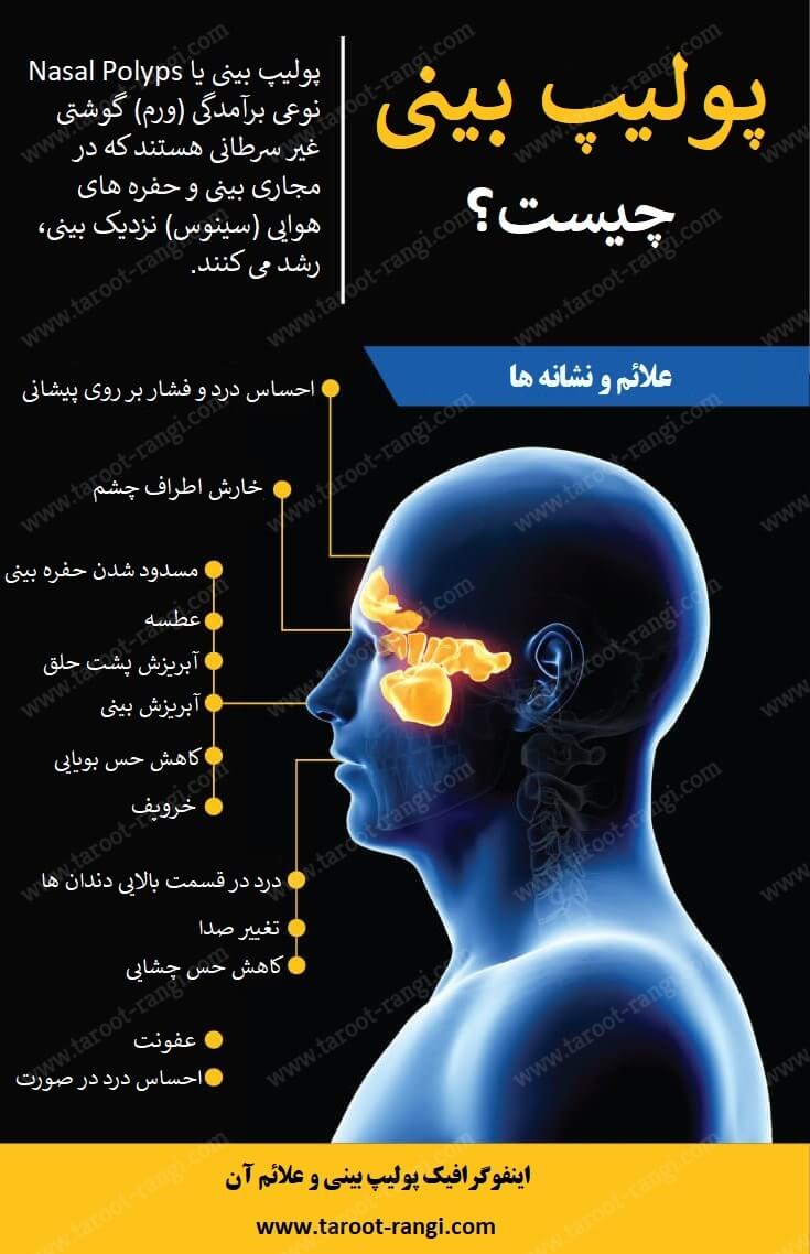 علائم پولیپ بینی