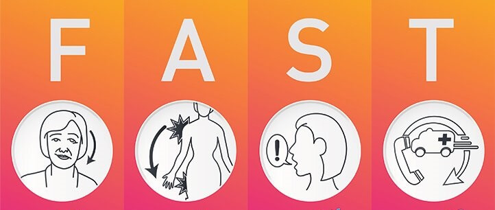 علائم سکته مغزی و شناسایی به موقع آن