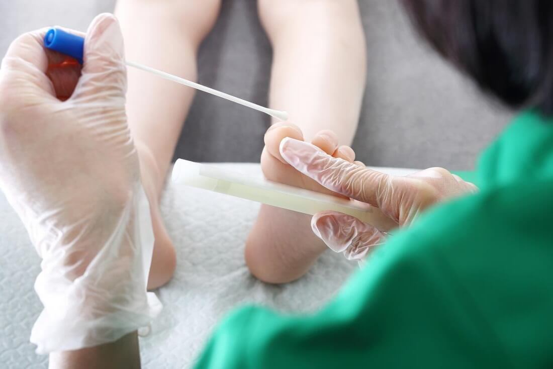 استفاده از تست پاپ اسمیر برای تشخیص سرطان دهانه رحم