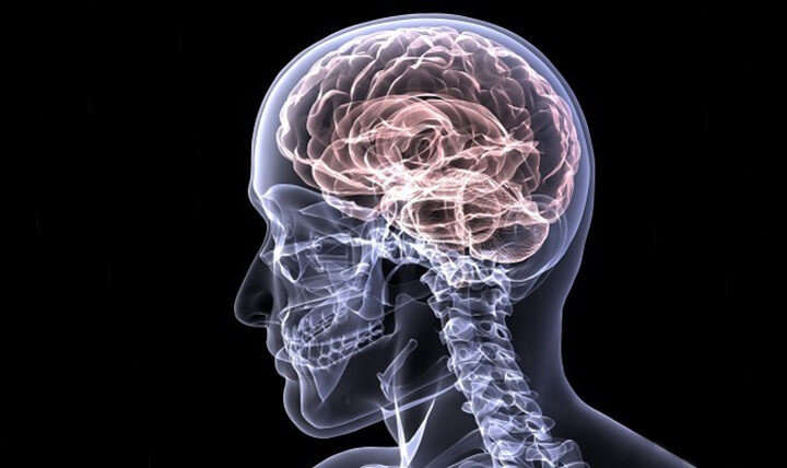 آلزایمر و زوال عقل