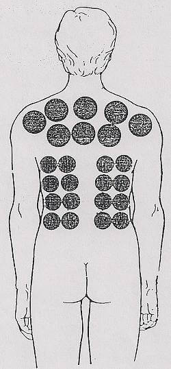 بادکش رماتیسم