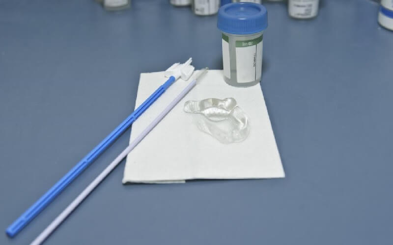 تشخیص زگیل تناسلی